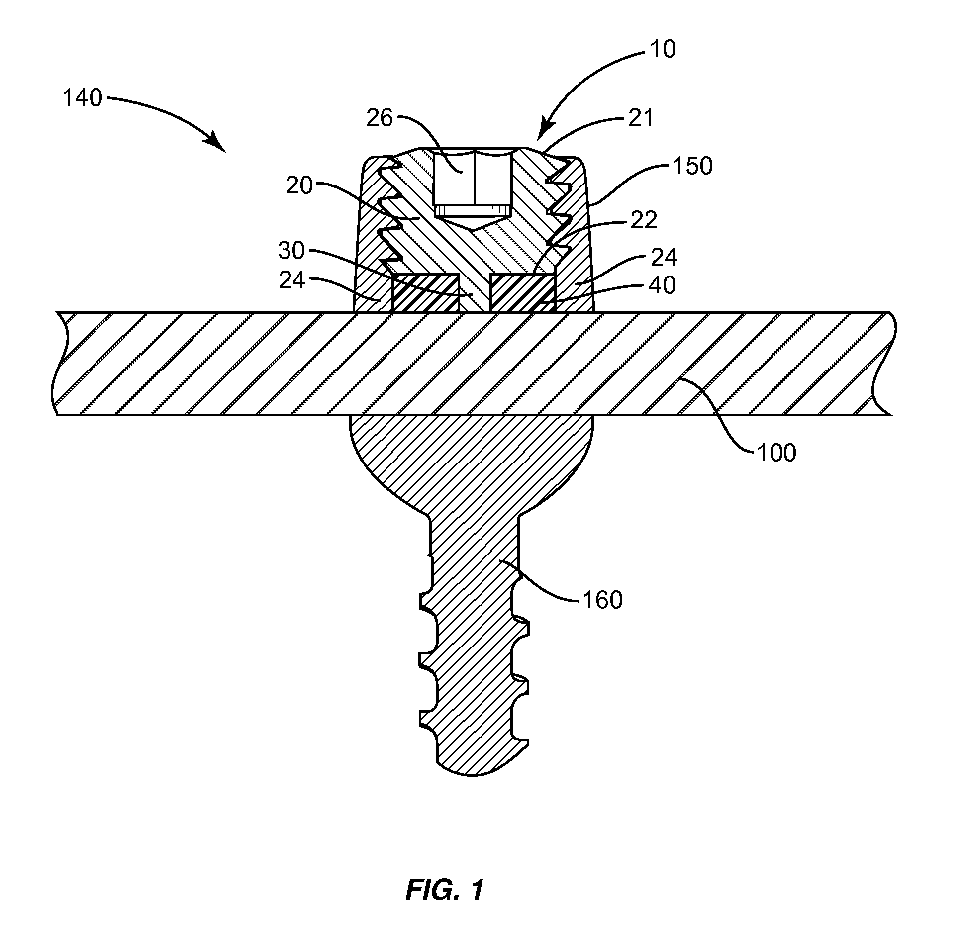 Set screw with deformable member