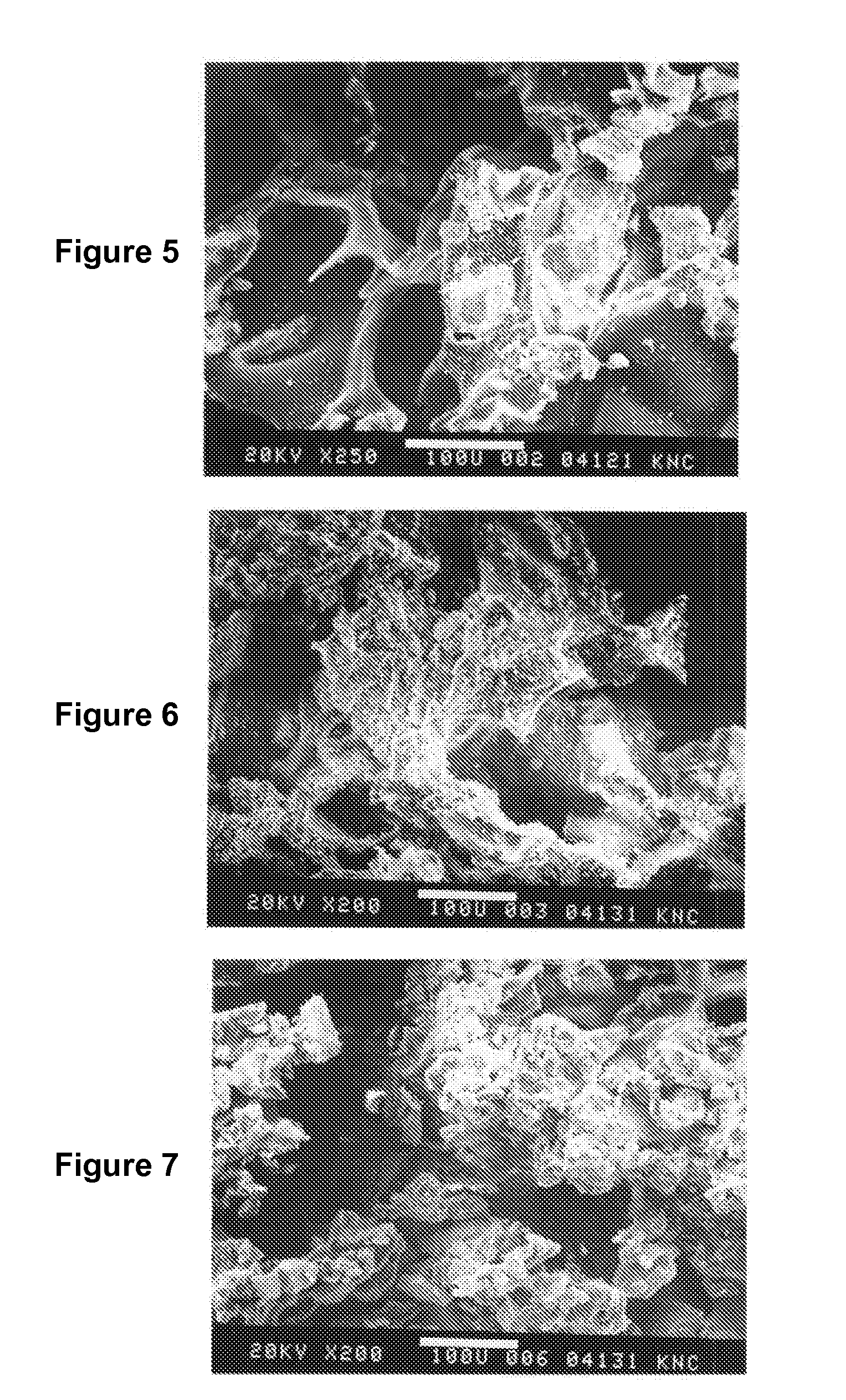 Resorbable structure for treating and healing of tissue defects