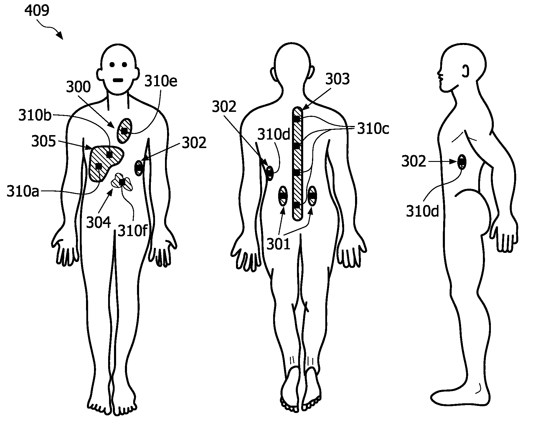 System for determining a distribution of radioactive agents in a subject