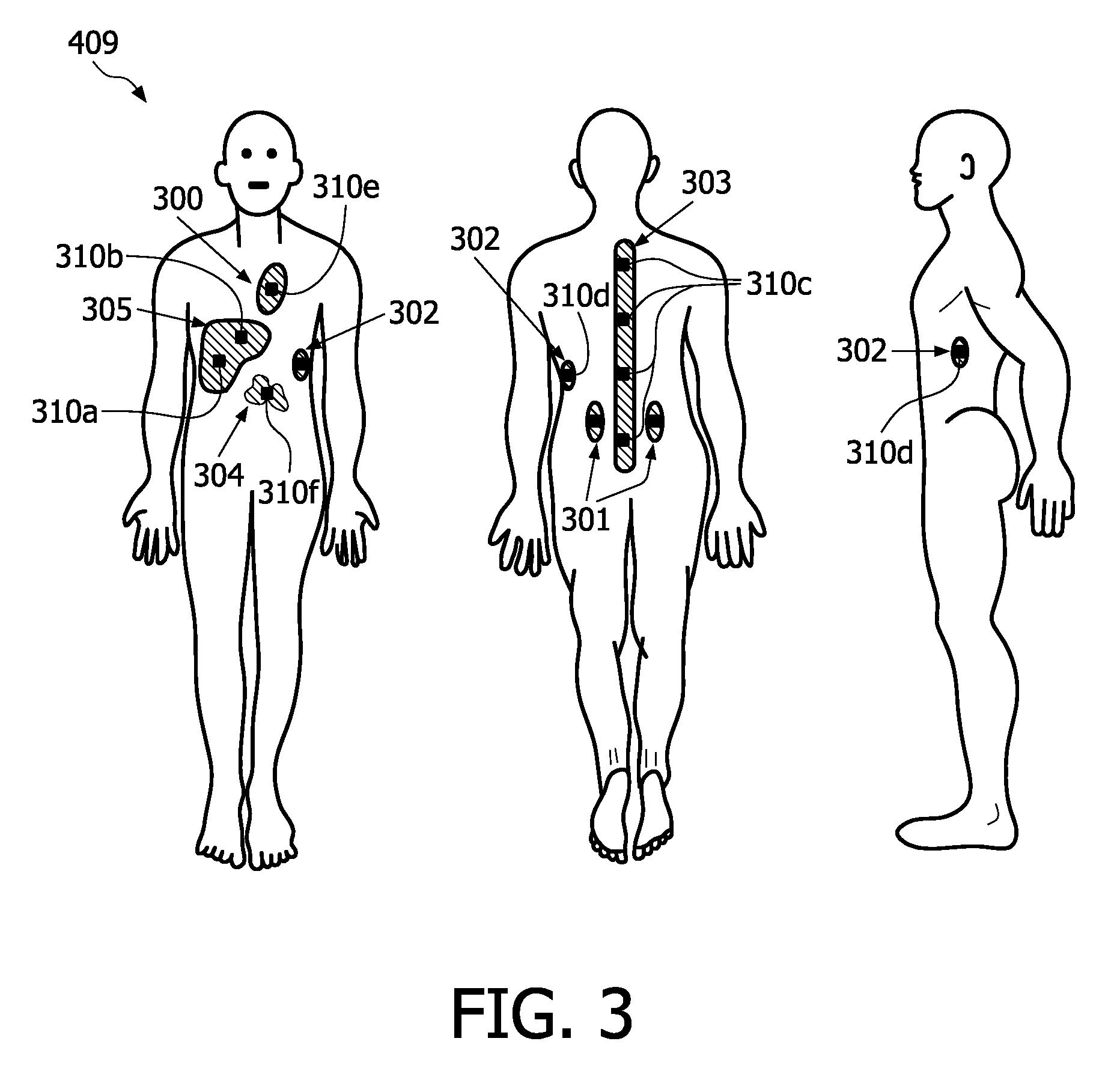 System for determining a distribution of radioactive agents in a subject