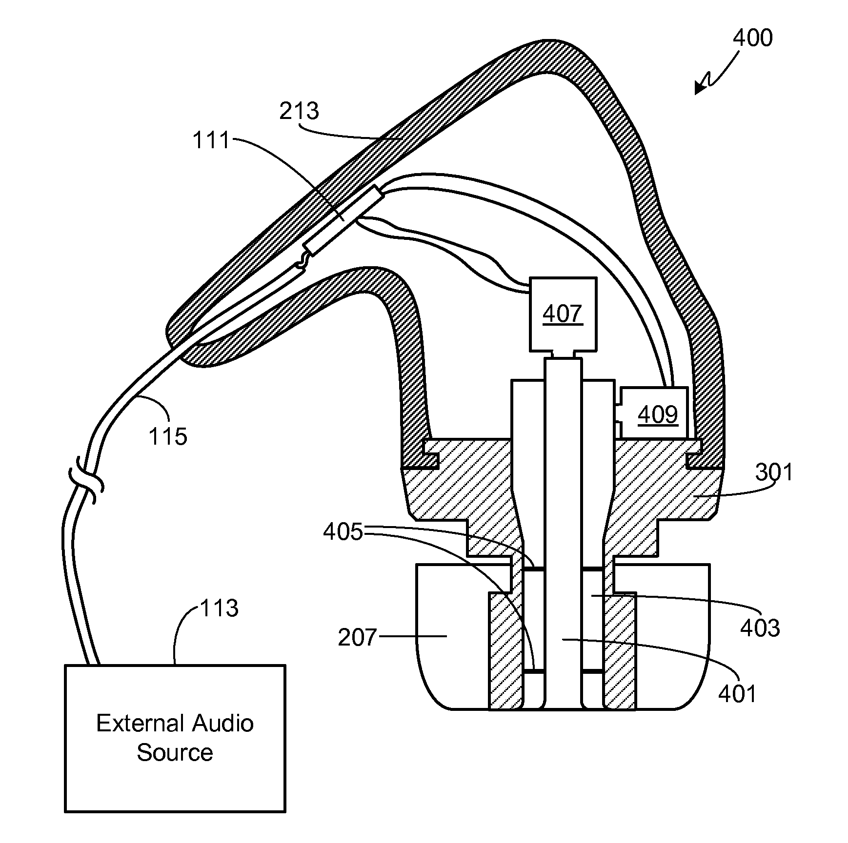 In-Ear Monitor with Concentric Sound Bore Configuration