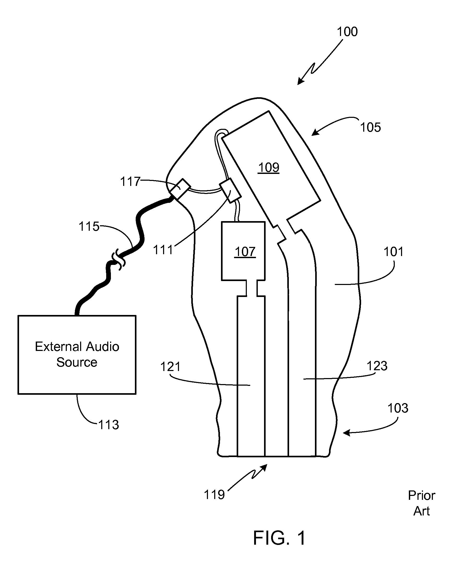 In-Ear Monitor with Concentric Sound Bore Configuration