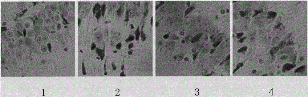 Pharmaceutical composition for preventing vascular dementia and its application