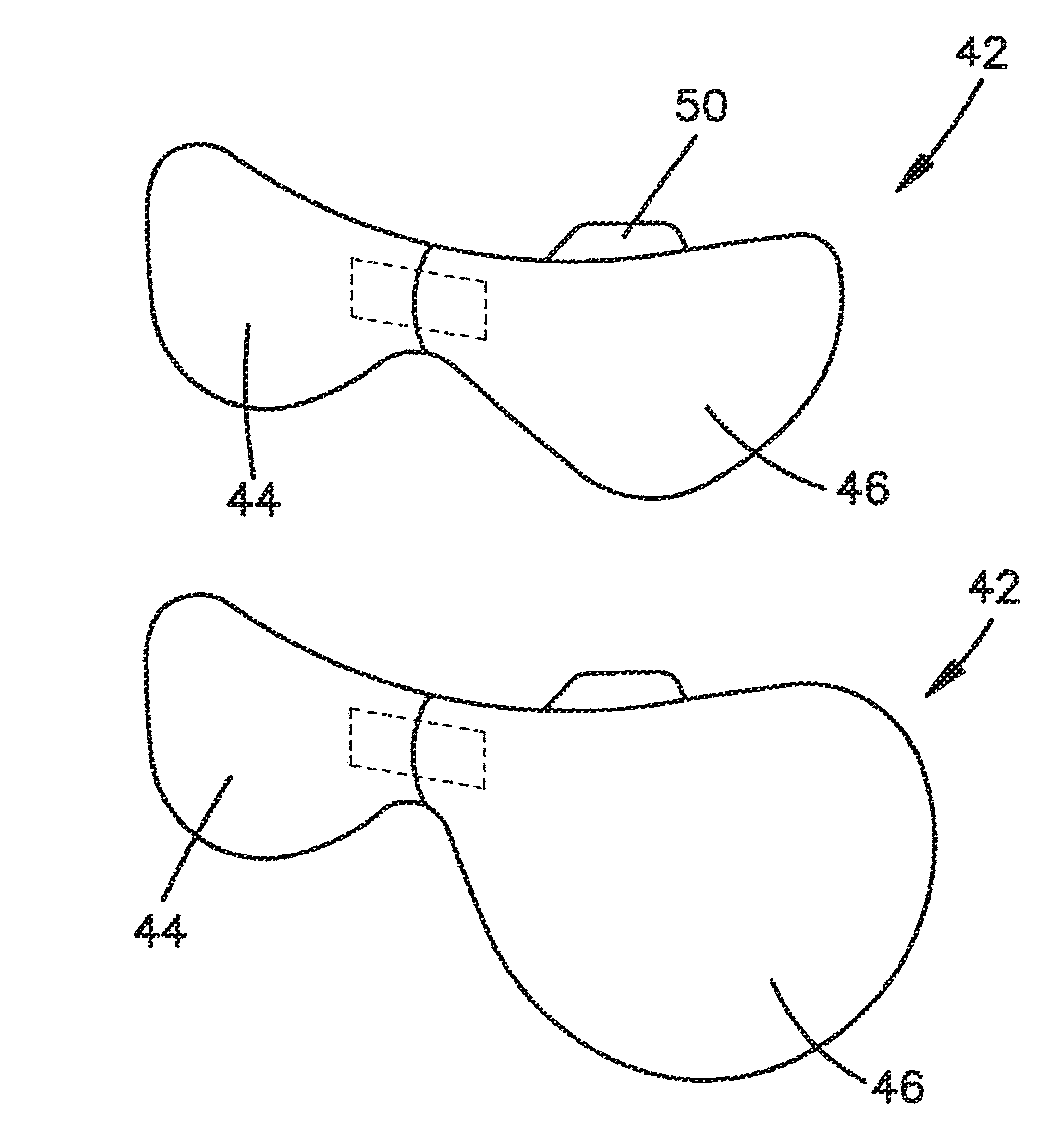 Craniofacial surgery implant systems and methods