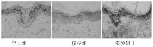 Anti-aging wrinkle-removing nano-preparation as well as preparation method and use thereof