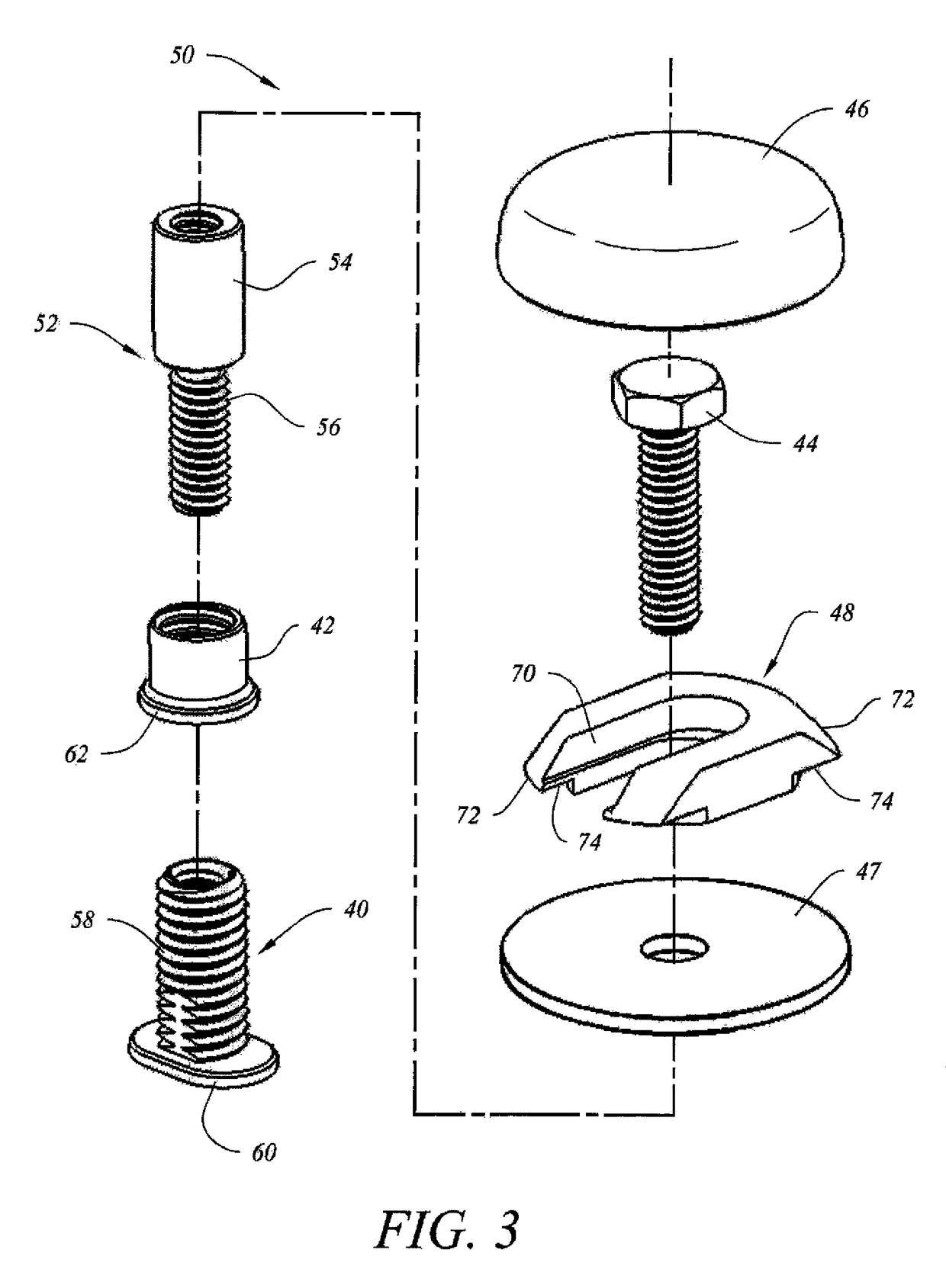Toilet fastener assembly and method of use