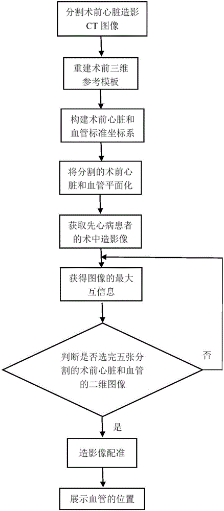 Apparatus and method for identifying blood vessels in angiography-assisted congenital heart disease operation