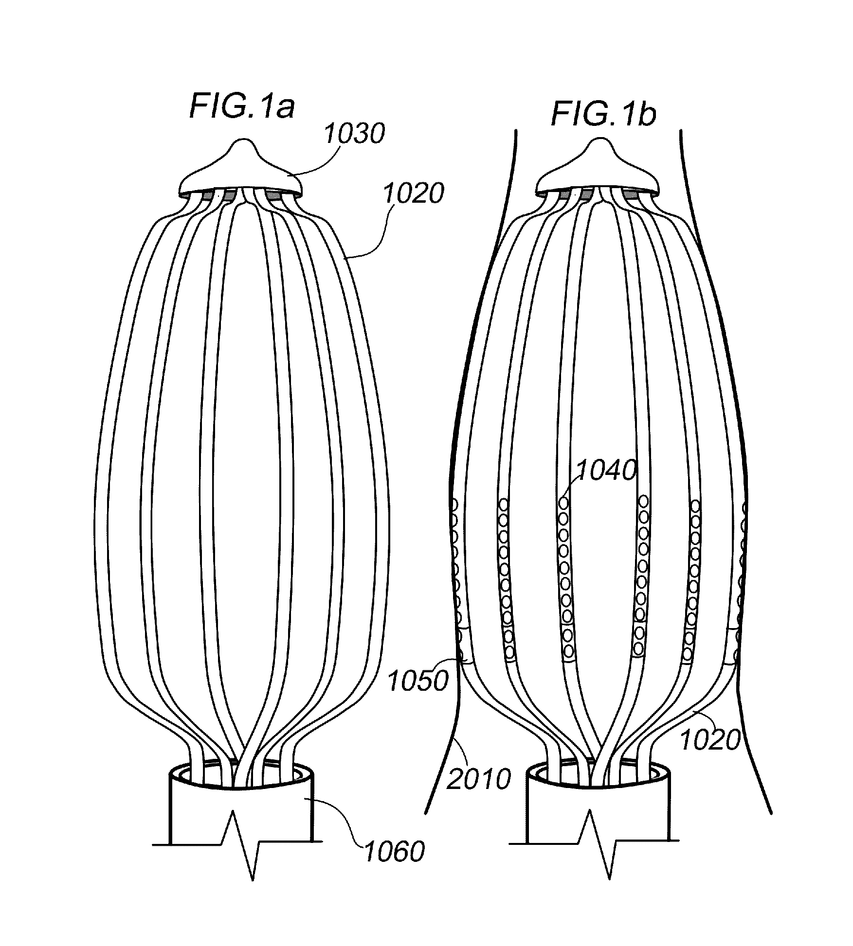 Apparatus and method for assessing tissue composition
