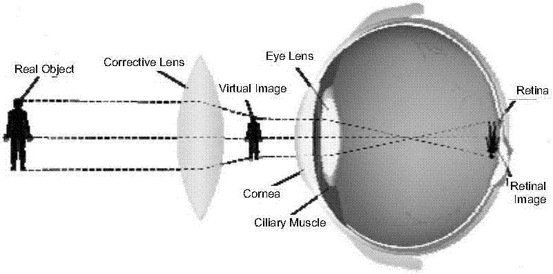 Vision correction method and device