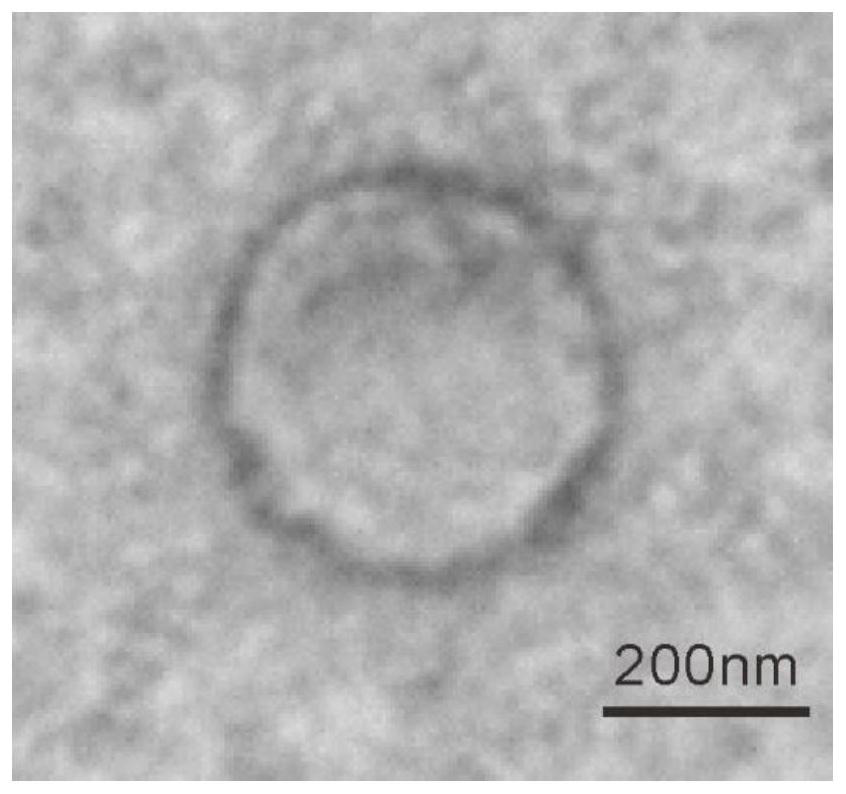 Preparation method of microparticles for preventing novel coronavirus and application