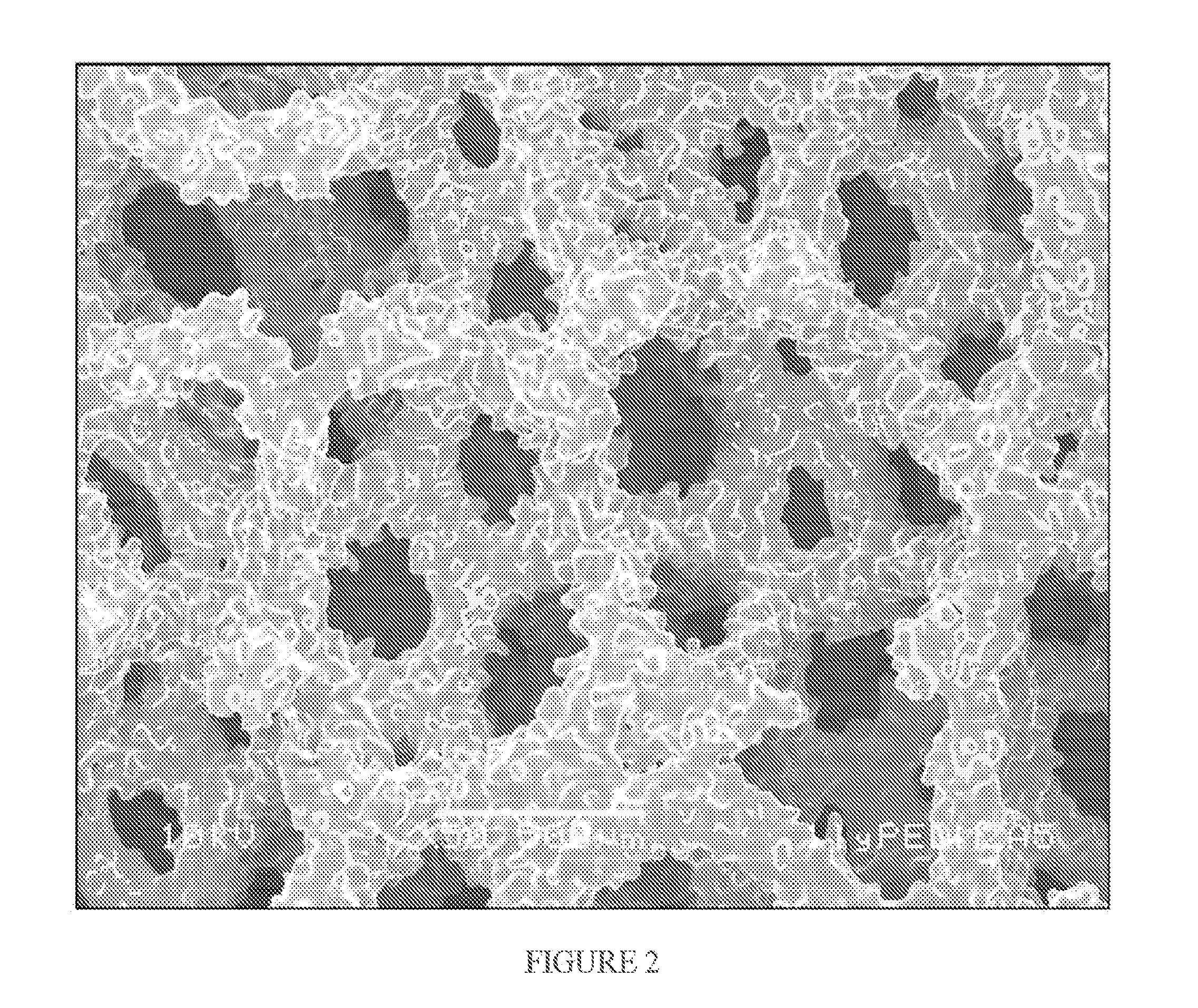 Porous surface layers with increased surface roughness and implants incorporating the same