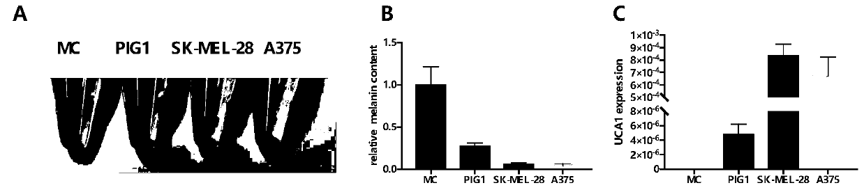 Application of uca1 as a target site in the preparation of drugs for the treatment of hyperpigmented skin diseases