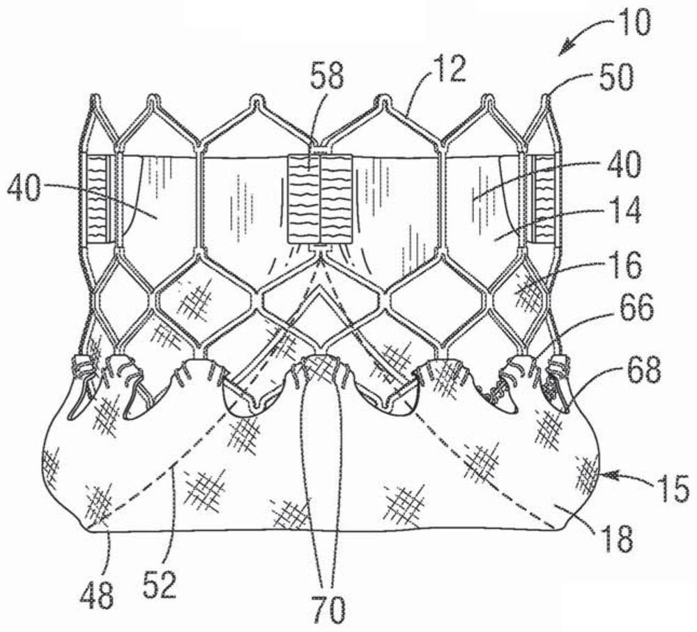 Method of assembling a prosthetic heart valve