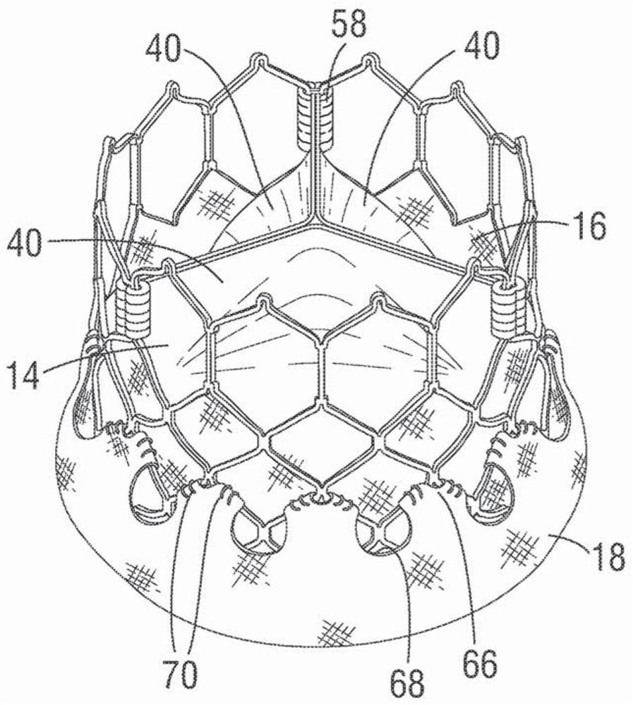 Method of assembling a prosthetic heart valve