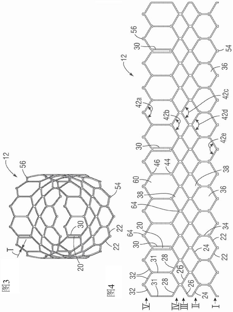 Method of assembling a prosthetic heart valve