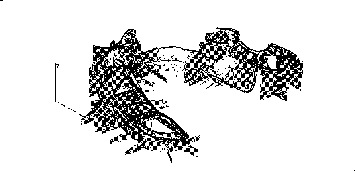 Method for quickly producing removalbe partial denture bracket