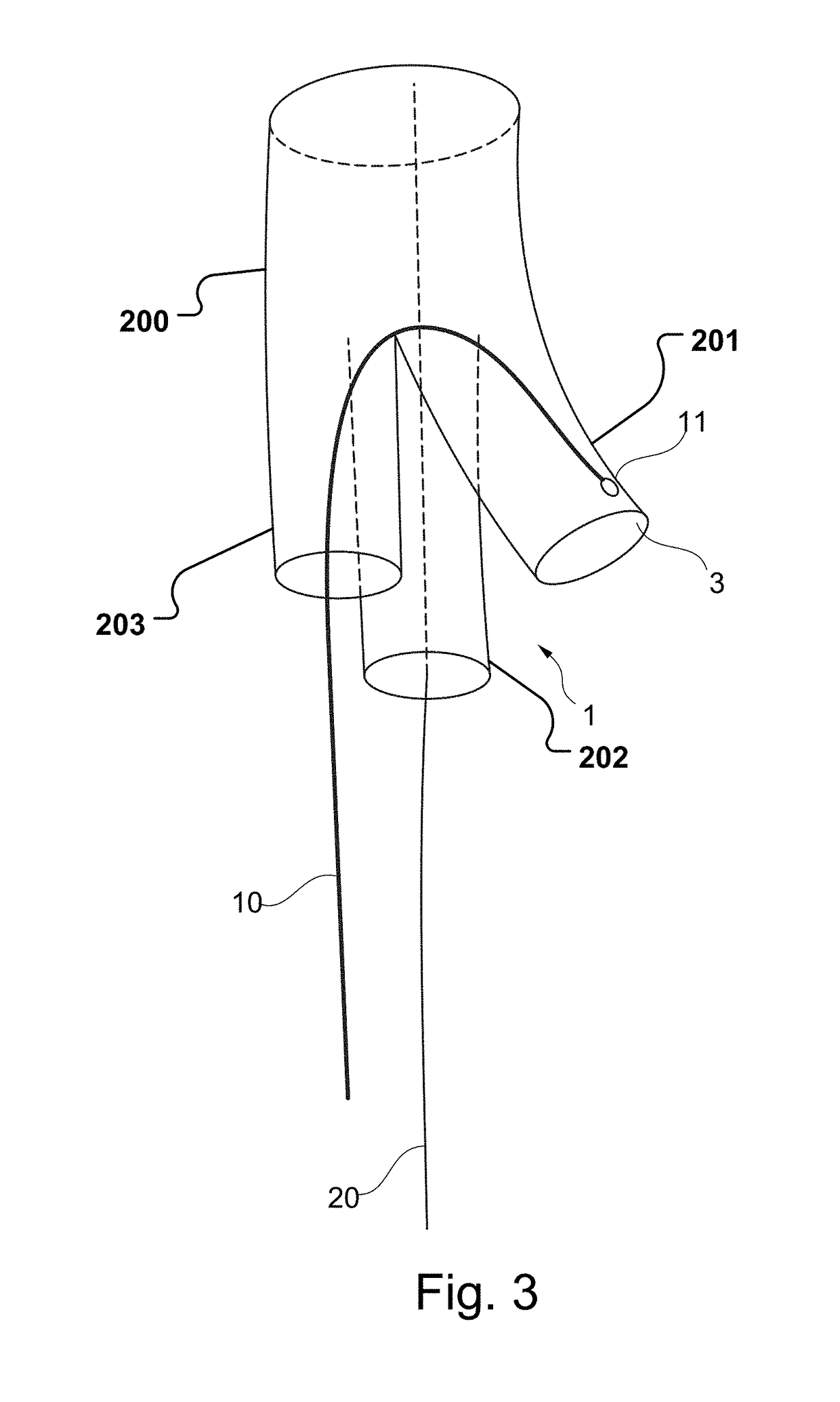 Vascular Medical Device, System And Method