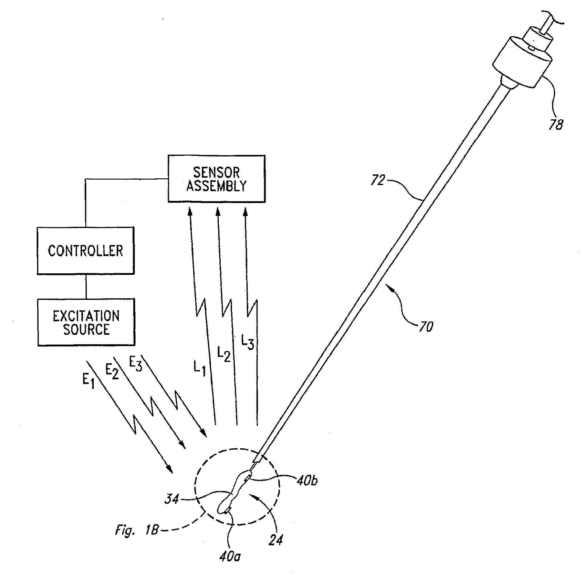 Apparatus and methods for using an electromagnetic transponder in orthopedic procedures