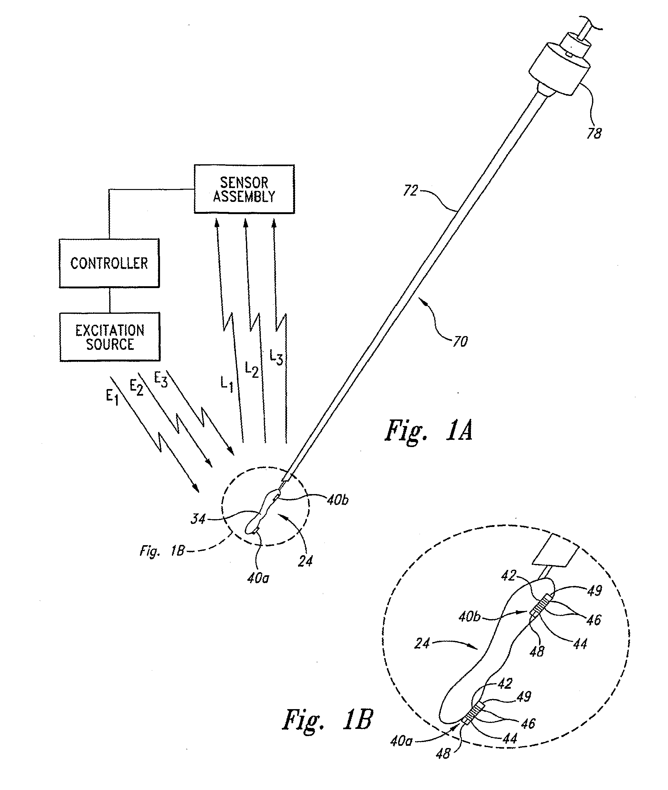 Apparatus and methods for using an electromagnetic transponder in orthopedic procedures