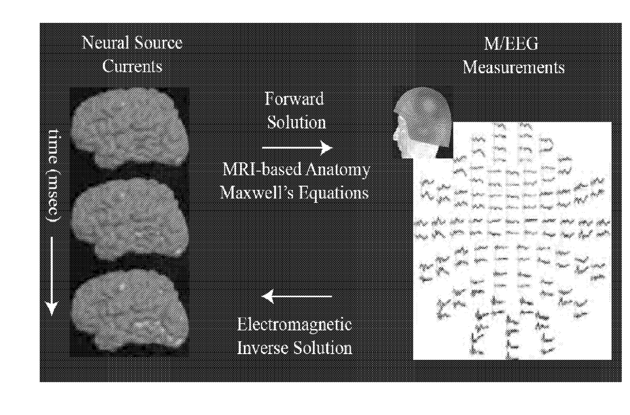 Deep brain source imaging with m/eeg and anatomical MRI