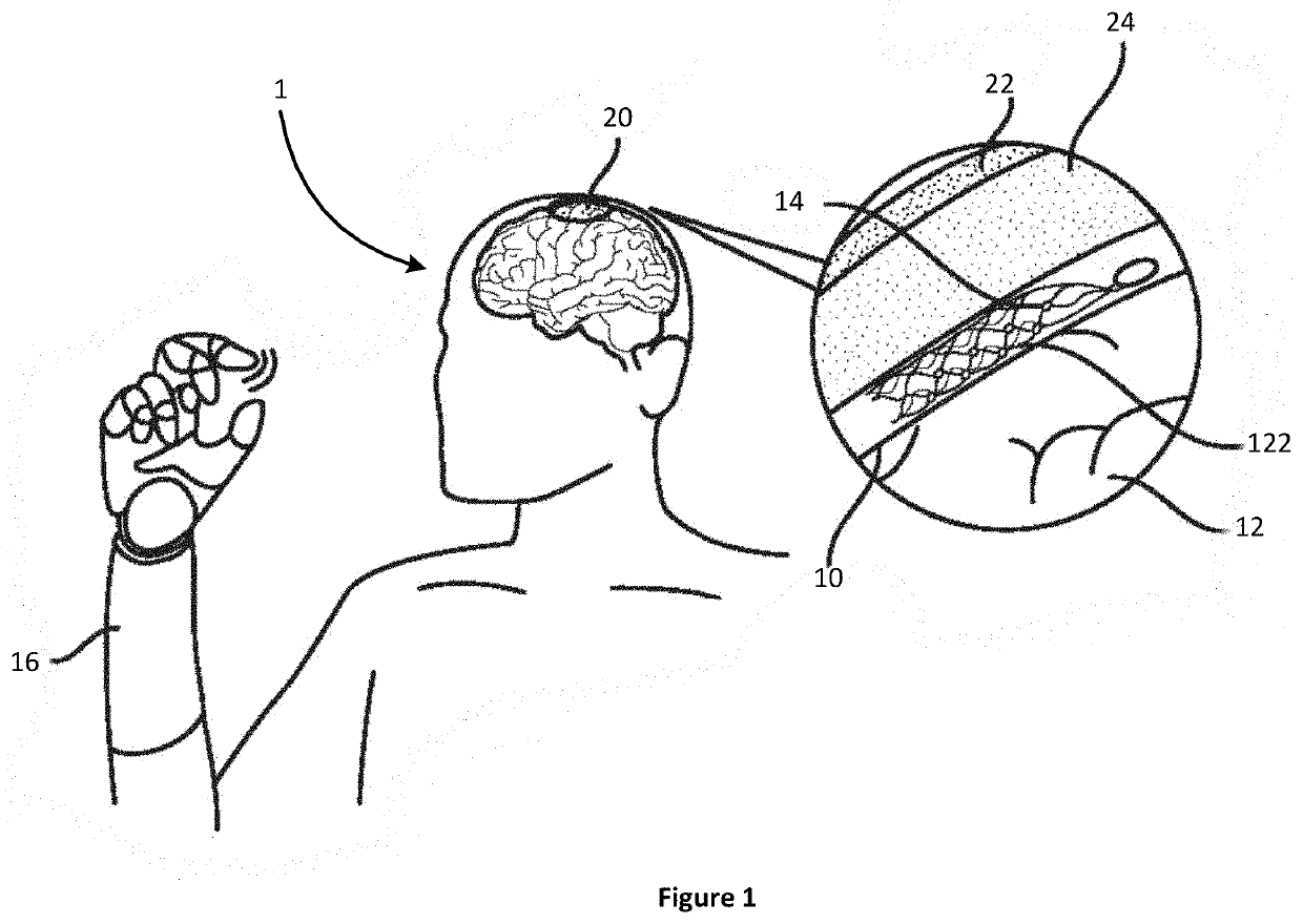 Systems and methods for improving placement of devices for neural stimulation