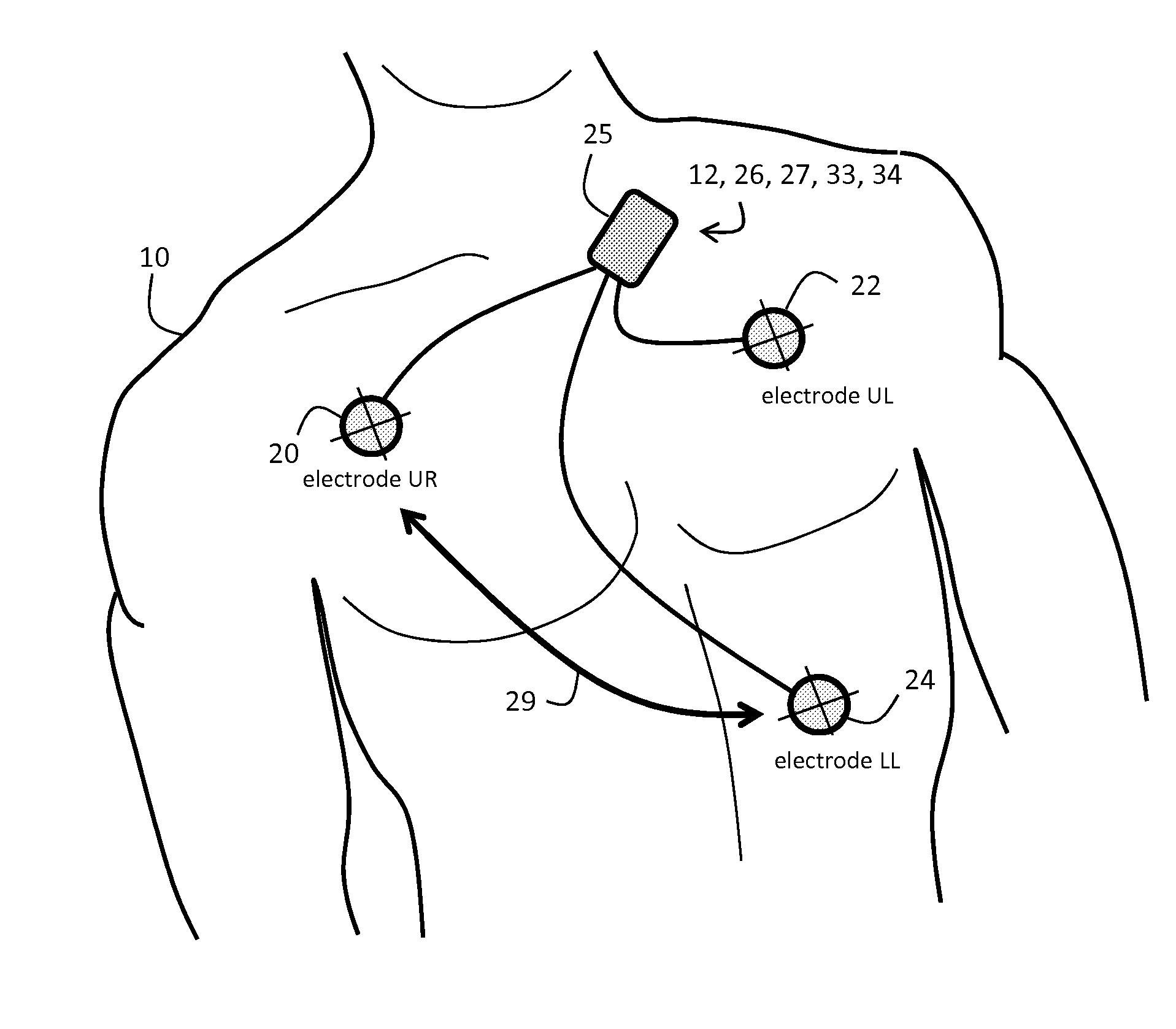 Body-worn monitor for measuring respiratory rate