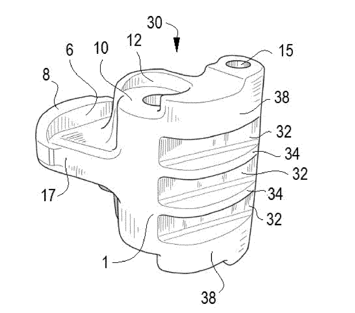 Railroad Coupler Knuckle with External Weight Reducing Features and Method of Forming the Same