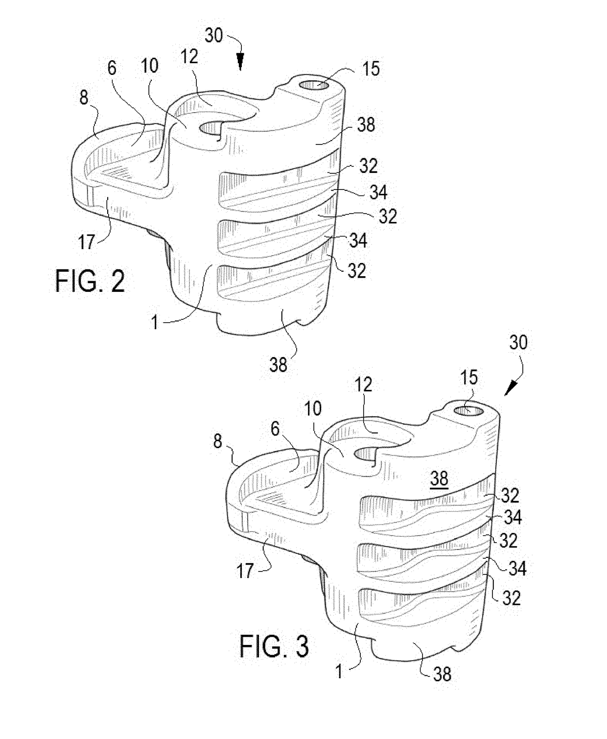 Railroad Coupler Knuckle with External Weight Reducing Features and Method of Forming the Same