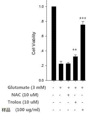 Applications of gendarussa vulgaris Nees extract as neuroprotective agent