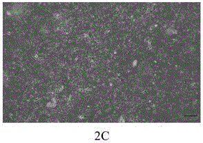 Method for culturing umbilical cord mesenchymal stem cells in separated mode from umbilical cord outer layer amnion tissue
