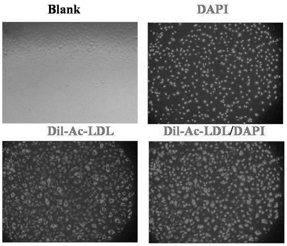 An Efficient Isolation and Culture Method of Adipose Endothelial Progenitor Cells Without Coating