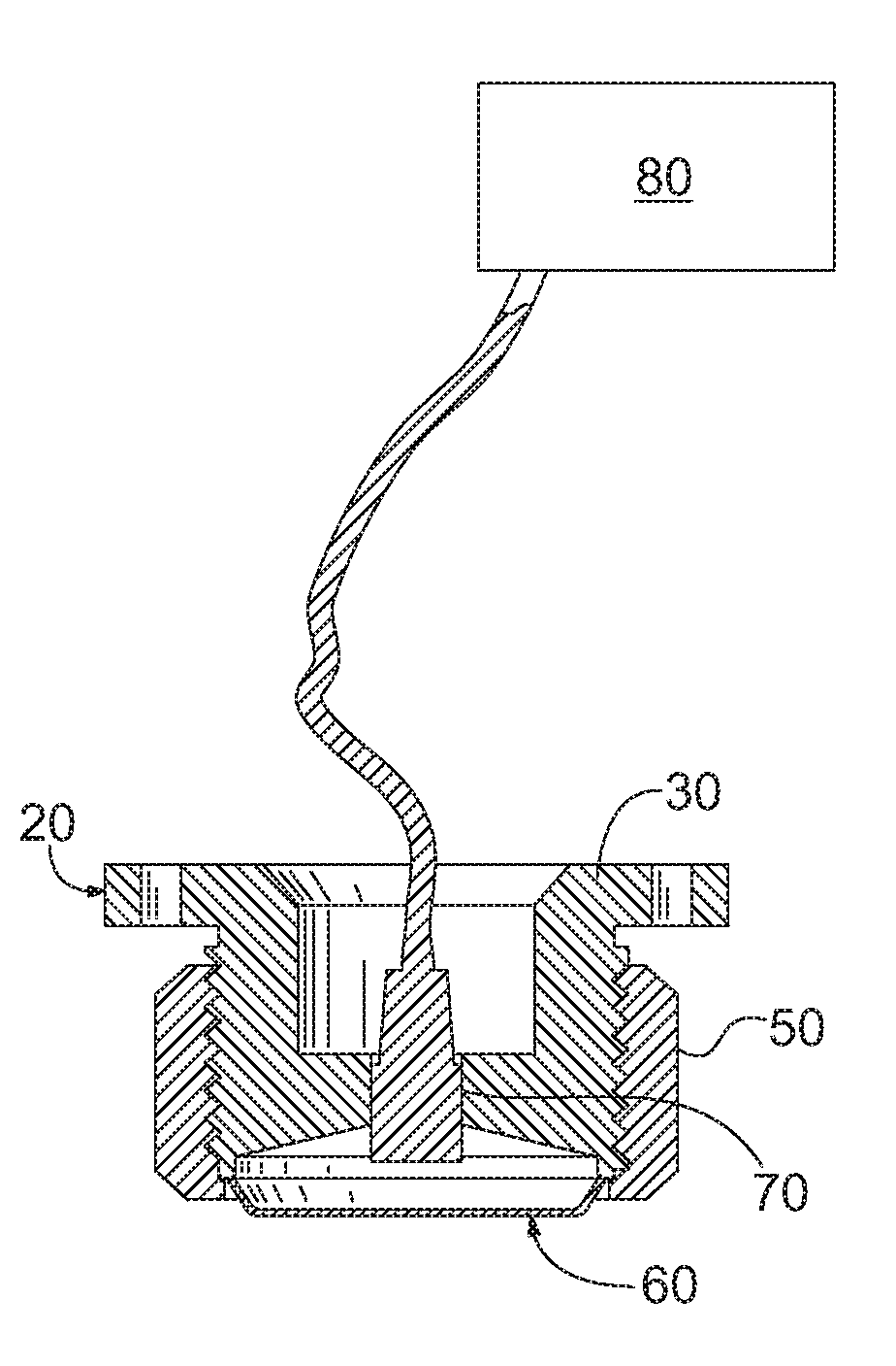 Method and apparatus for diagnosing a medical condition based upon audial data from a patient