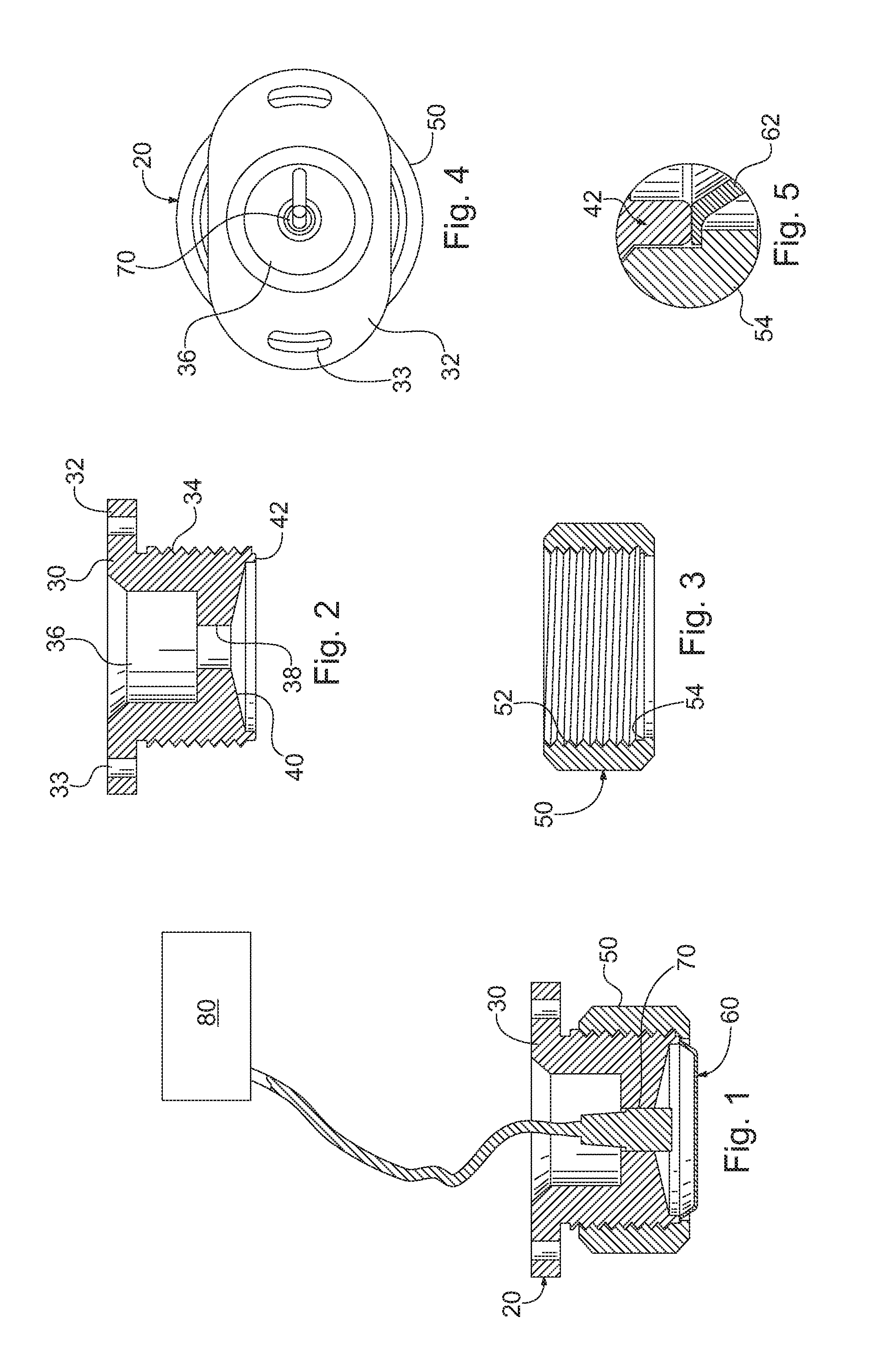 Method and apparatus for diagnosing a medical condition based upon audial data from a patient