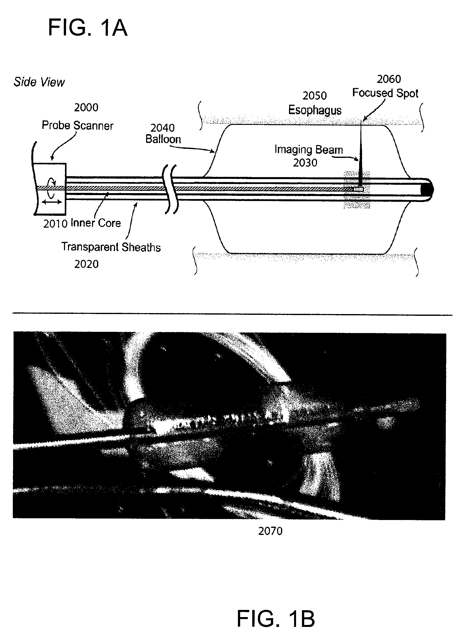 Methods and systems for monitoring and obtaining information of at least one portion of a sample using conformal laser therapy procedures, and providing electromagnetic radiation thereto