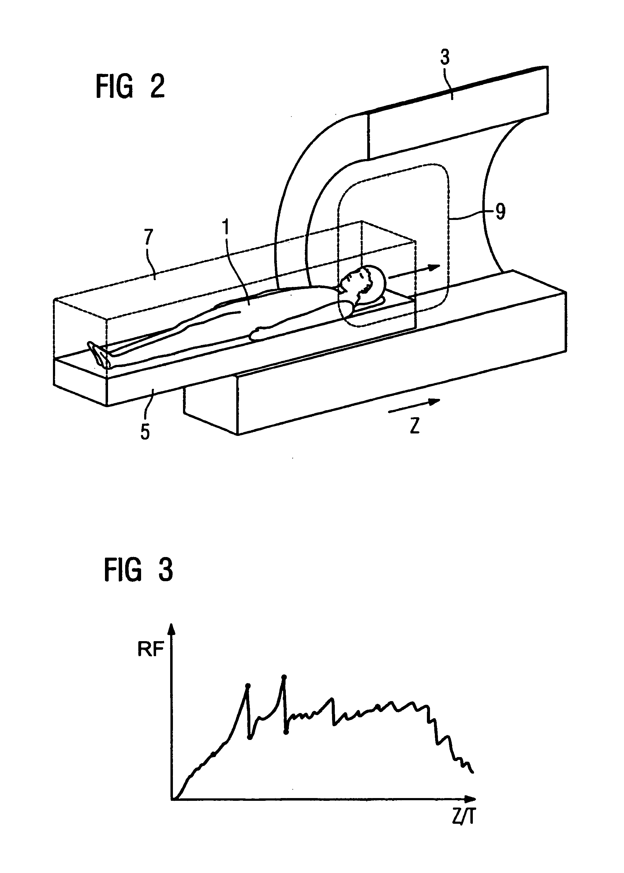 Method for implementation of a magnetic resonance examination of a patient