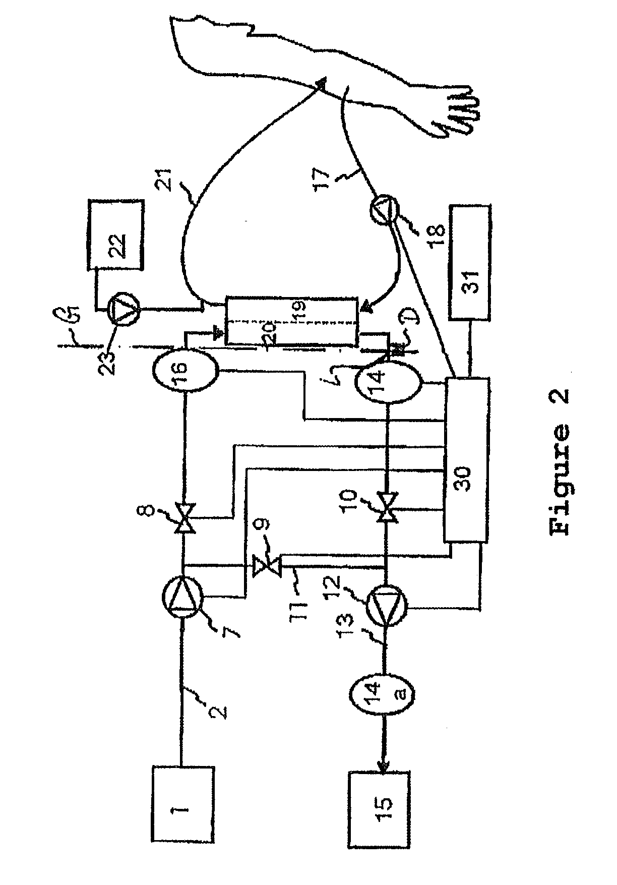 Device for extracorporeal blood treatment