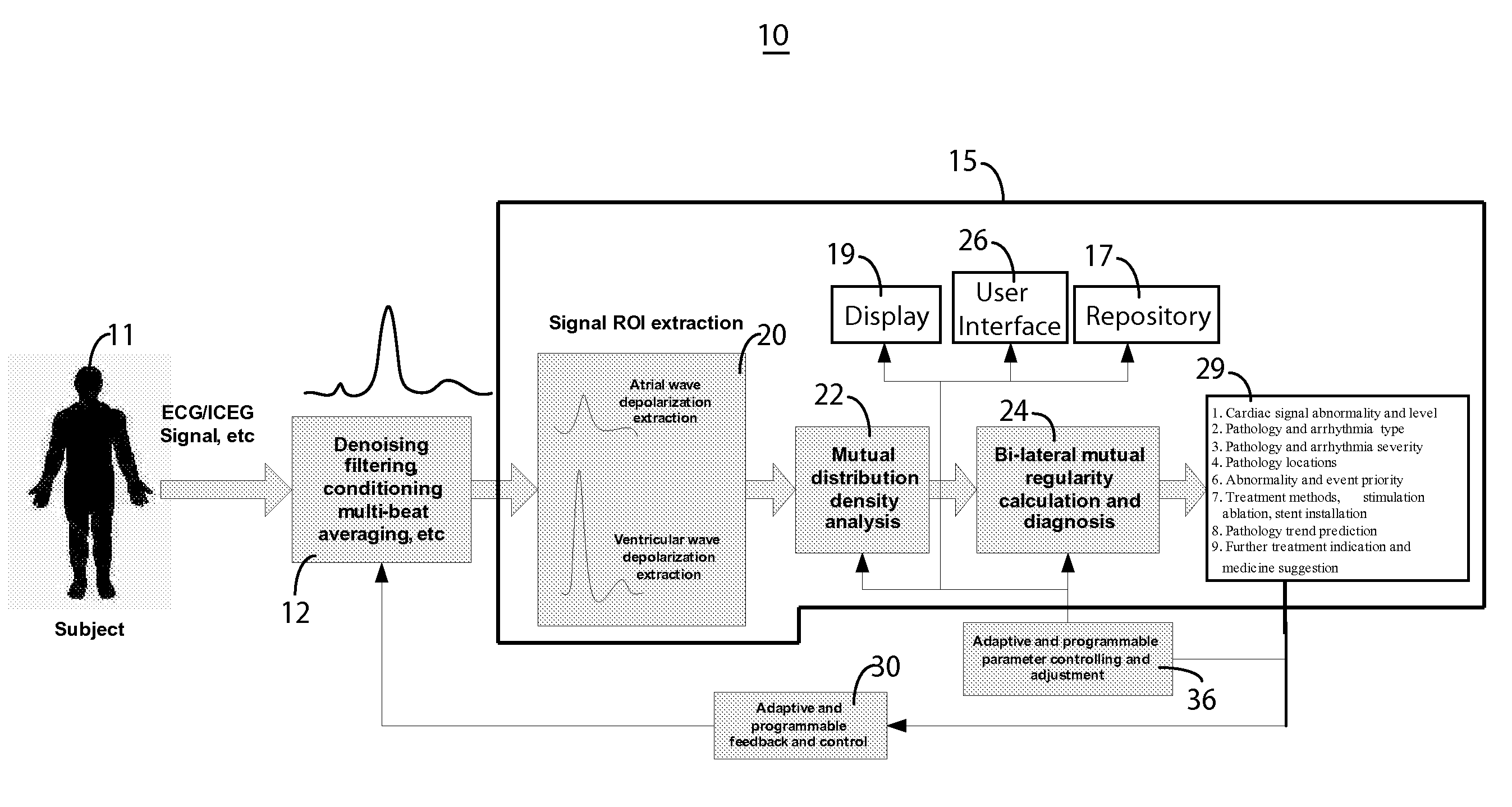 System for cardiac impairment detection based on signal regularity