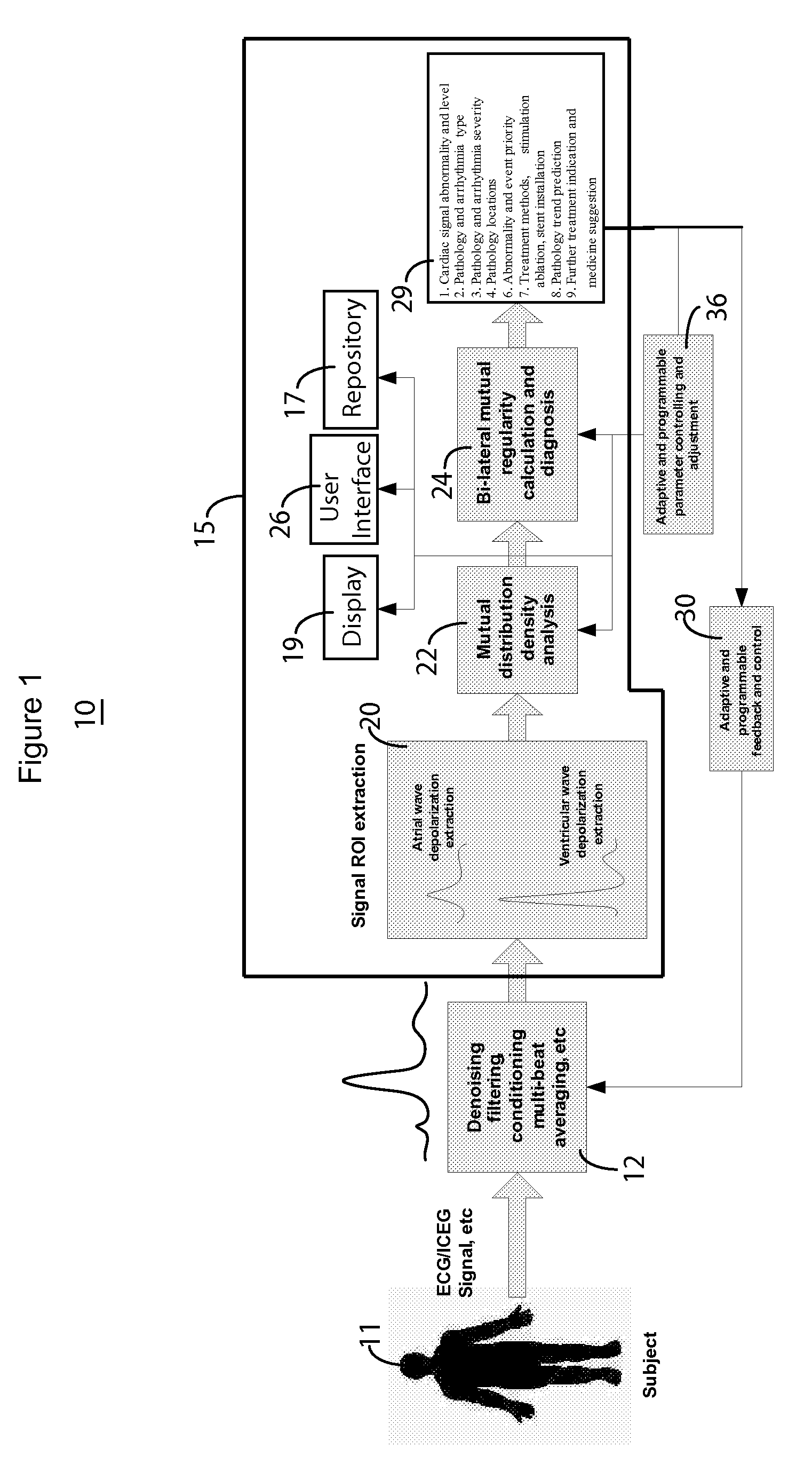 System for cardiac impairment detection based on signal regularity