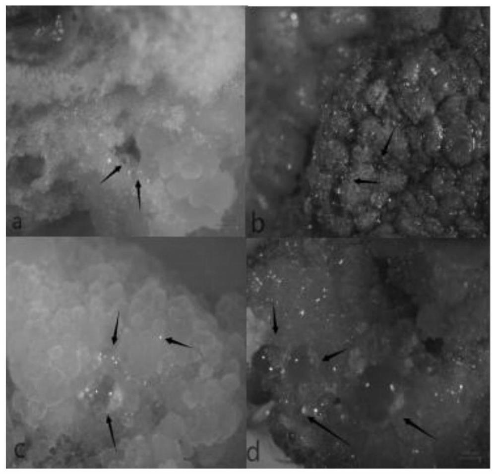 A Somatic Cell Culture Method for Effectively Promoting Globular Embryogenesis of Quercus mongolica