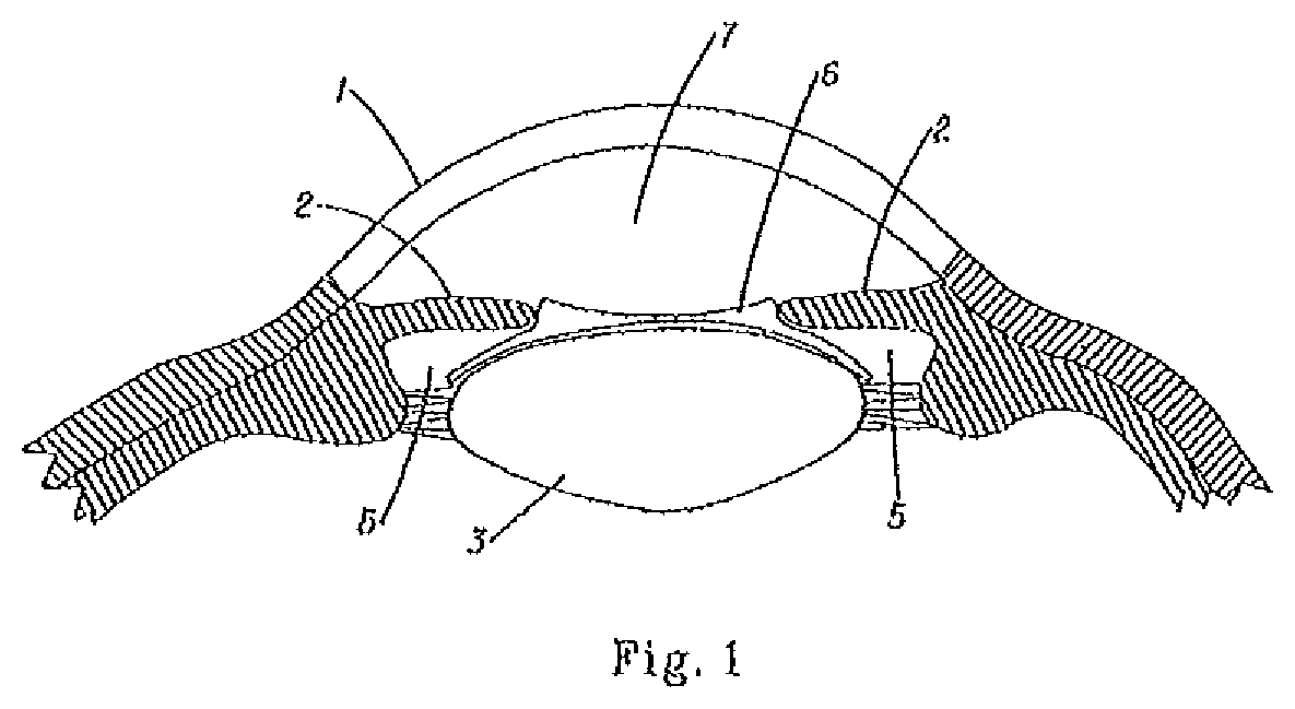 Self-centering phakic refractive lenses with parachute design