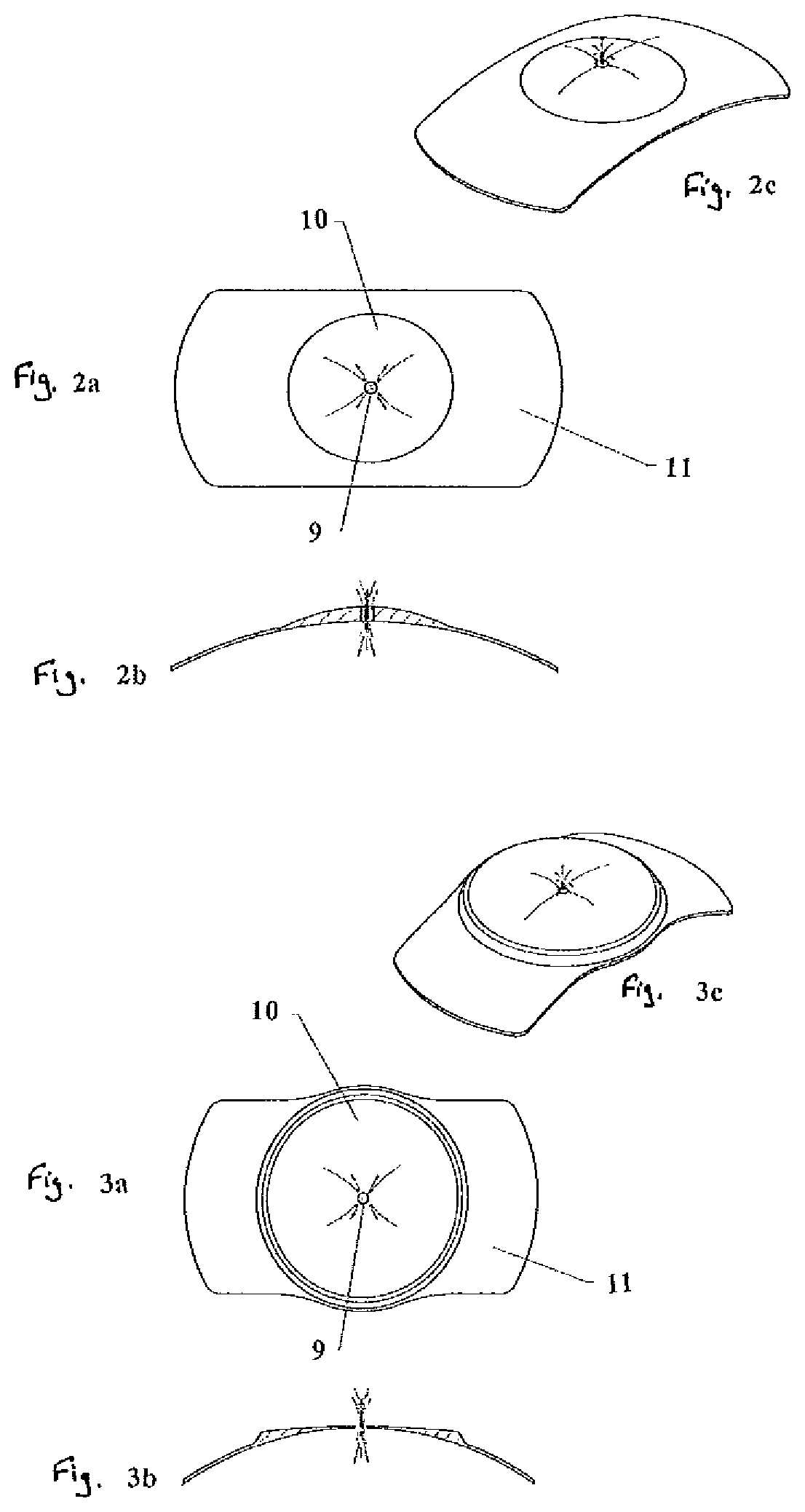 Self-centering phakic refractive lenses with parachute design