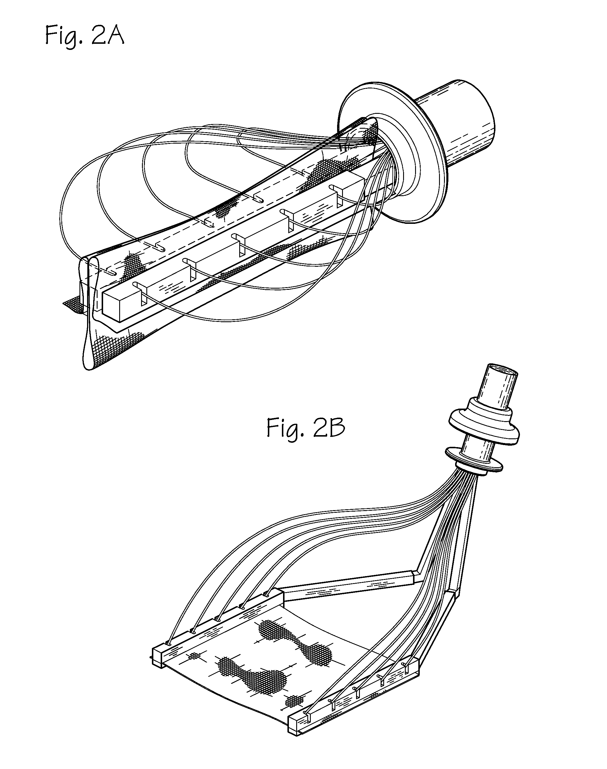 Method and devices for implantation of biologic constructs