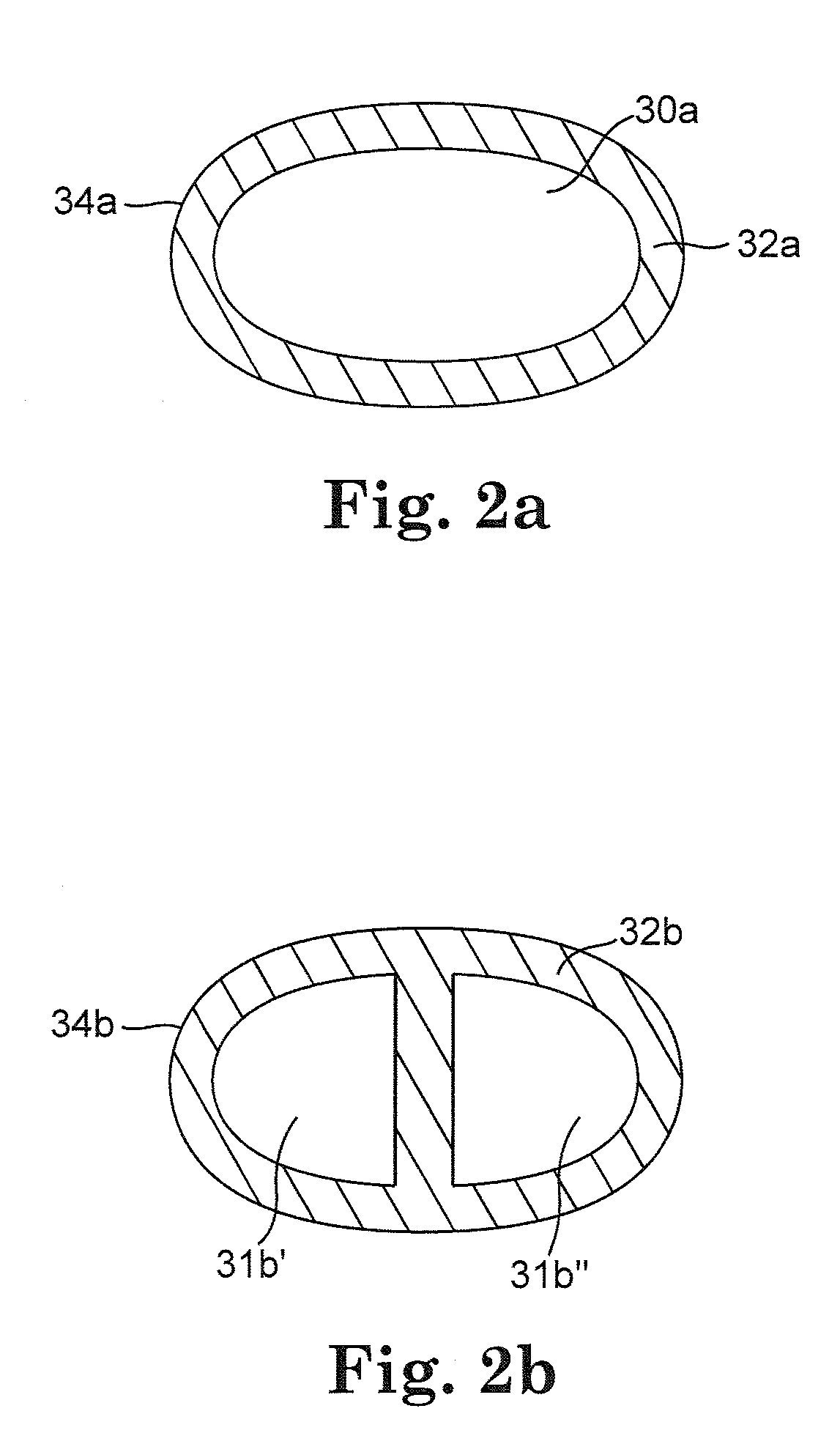 Implantable cerebrospinal fluid flow device and method of controlling flow of cerebrospinal fluid