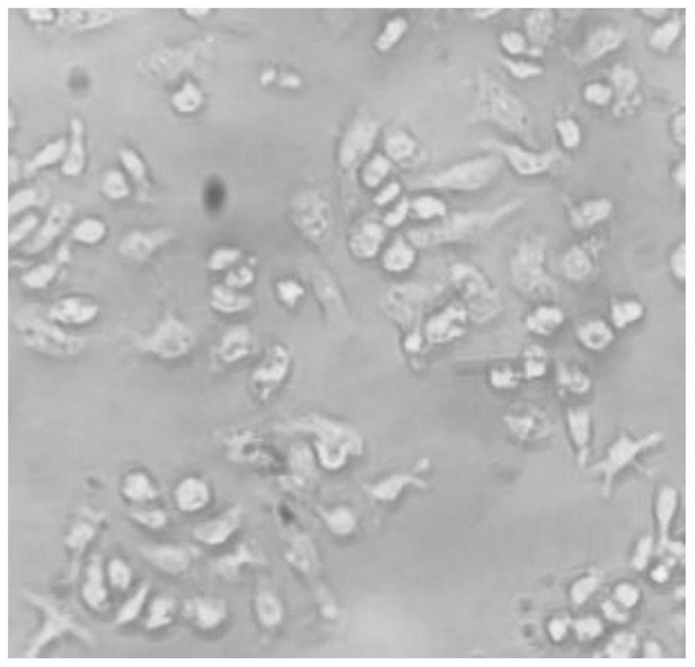 Radix pseudostellariae polysaccharide and preparation method thereof