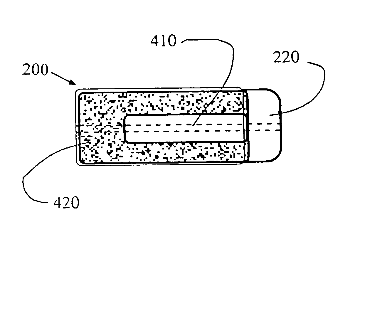 Method and apparatus for treating osteochondral pathologies