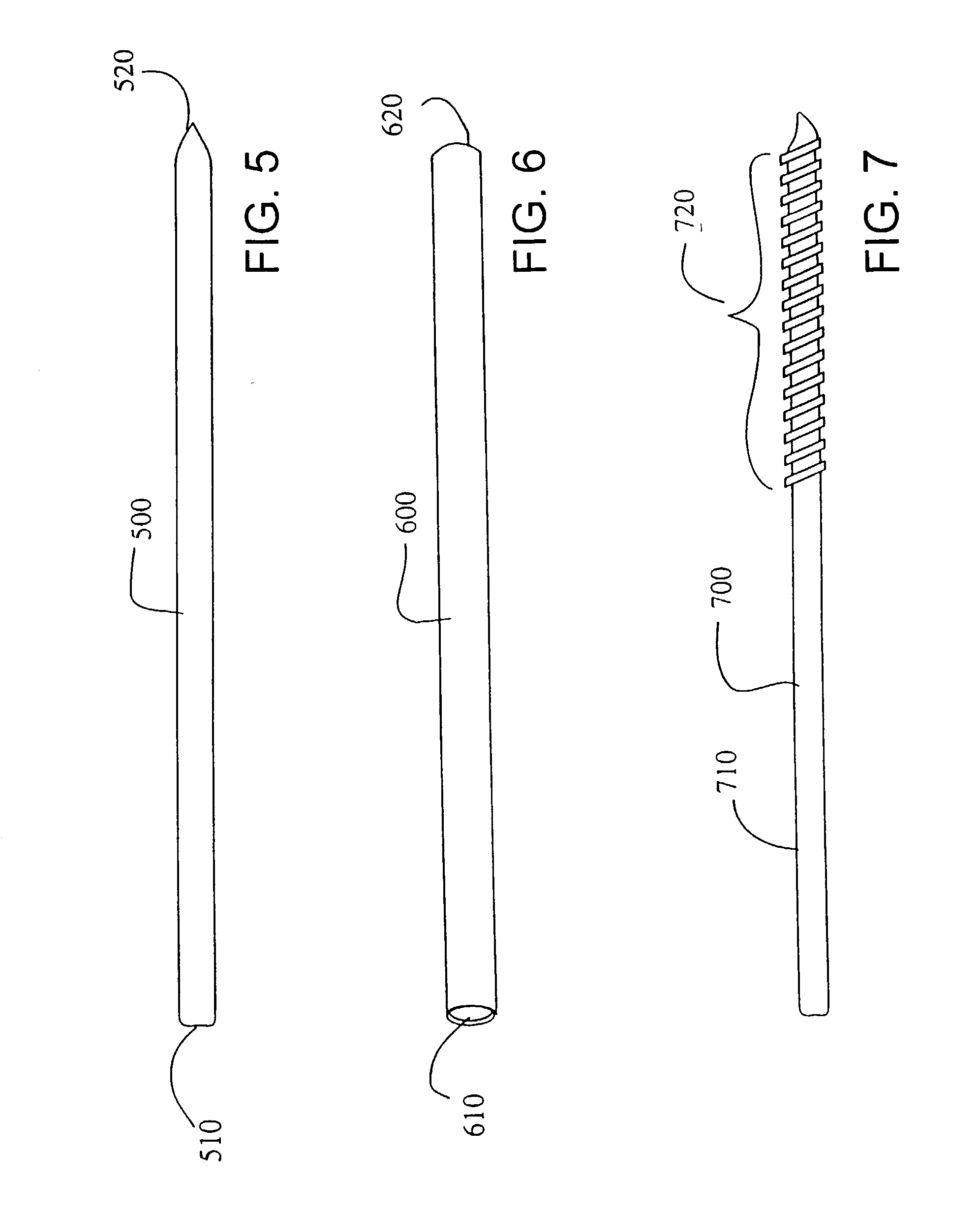 Method and apparatus for treating osteochondral pathologies