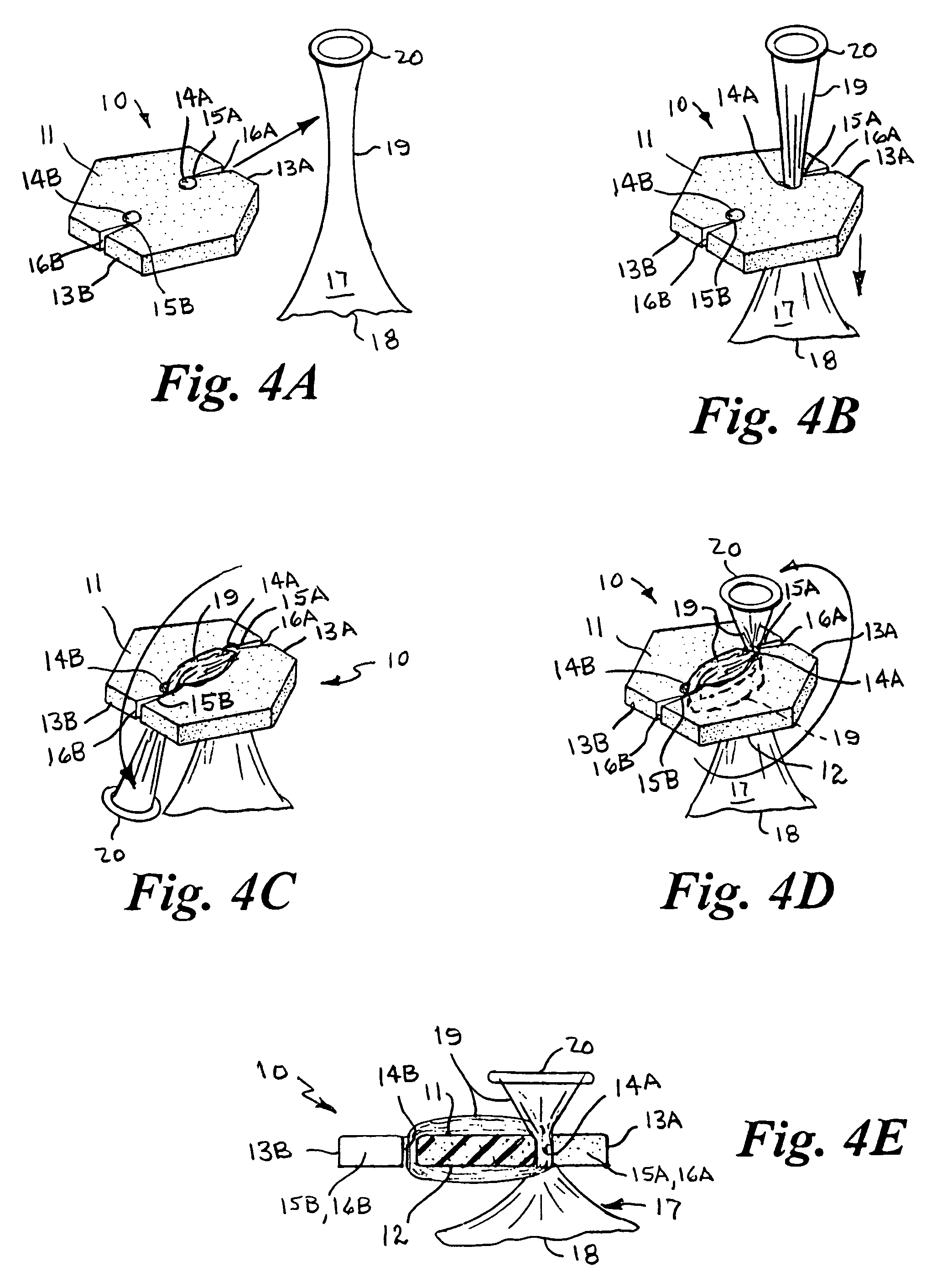 Safe balloon neck closure device and method