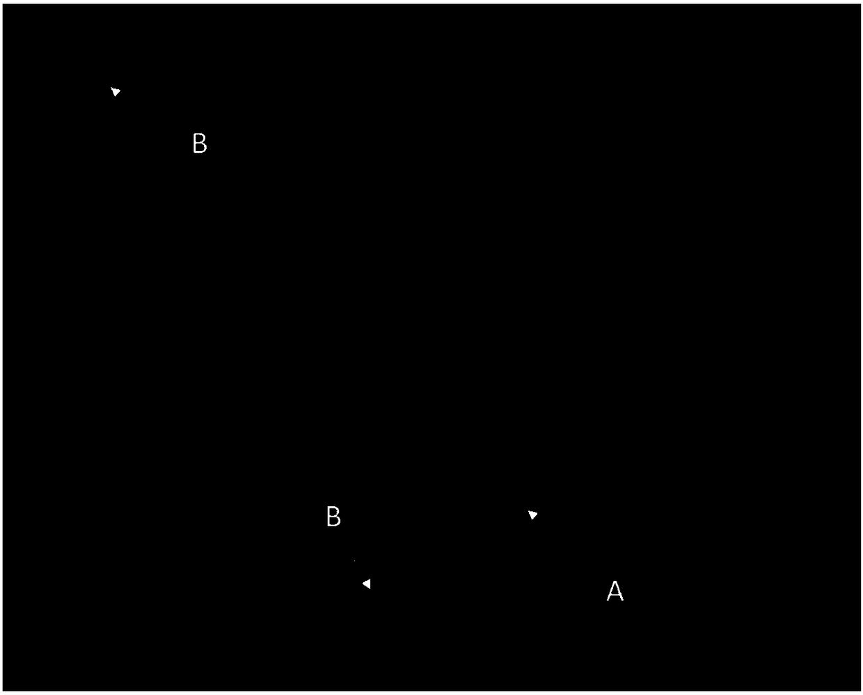 A kit for identifying circulating tumor cells using cd45 immunofluorescence combined with cep probe and its application