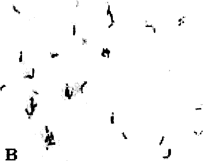 Nattokinase and its coding gene and clone and expressing method