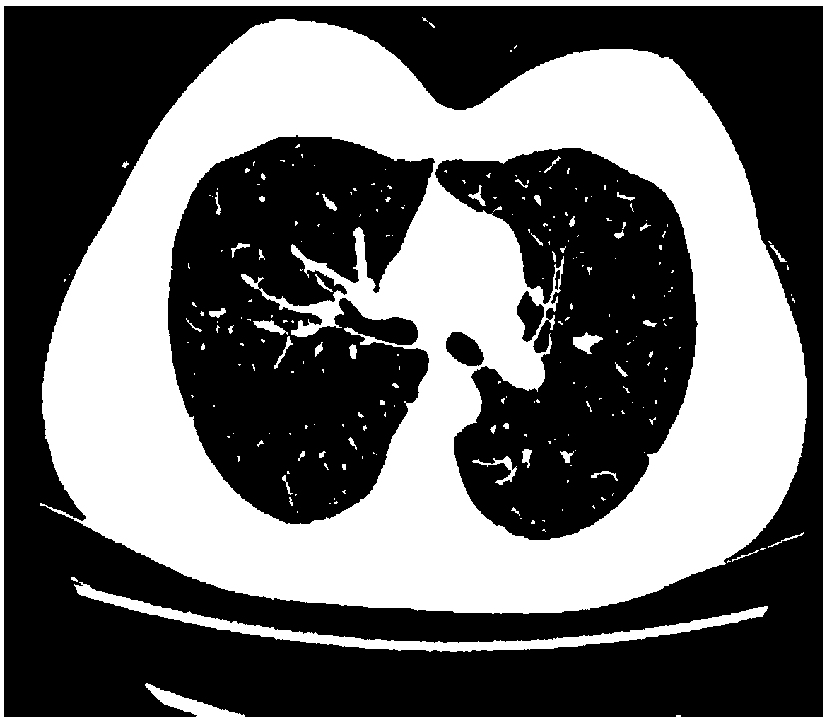 Pulmonary airway image segmentation method, terminal and storage medium